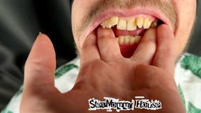 Custom! Guy biting the Stepmommy Fingers with his Molars close-up - Loud Moaning, Deep Skin Marks, Male Vampire Teeth 4k