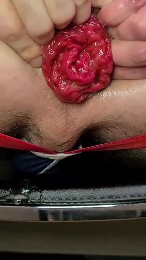 Captivating moment from "Extreme Anal Prolapse after my big 10 Inch Dildo"