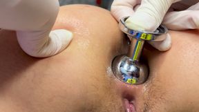 Enlarging my wife's anus to 4cm