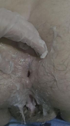 my asshole after being destroyed by my  partners  whole  fist!! it's disgustingly hot, isn't it?