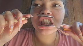 The Most Intimate Exposure: My Limitless Yellow Teeth