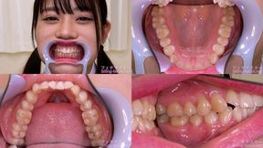 Rin Amasawa - Watching Inside mouth of Japanese cute girl