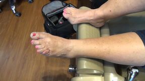 Deformed Foot Mature