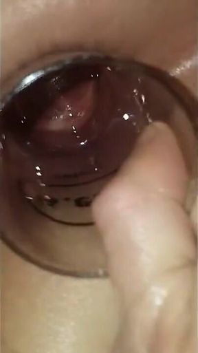Glass in Ass