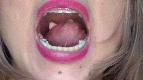 Swallowing Lots of Gummi Bears at Same Time!!