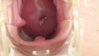 Speculum Bae spreading lips and masturbating vagina