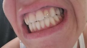 ONE MONTH WITHOUT BRUSHING MY TEETH – YELLOW DIRTY SMOKER TEETH CLOSE-UP