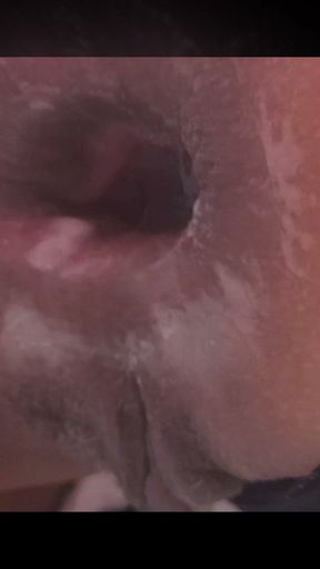 Beautiful ass prolapsing and pulsing after penis cum inside   Clip 1