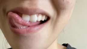 Aurora's Teeth Shine For You