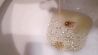 Adashah uses bottle cap and super glue on his micro penis chastity and piss