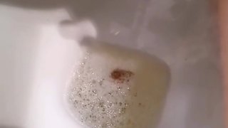 Adashah uses bottle cap and super glue on his micro penis chastity and piss
