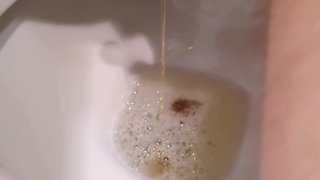 Adashah uses bottle cap and super glue on his micro penis chastity and piss