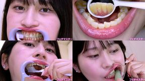 Maina Yuuri - Observing Maina's teeth with a dental mirror & brushing her teeth while wearing a mouth opener & finger toothbrushing while wearing a lip hook - 1080p