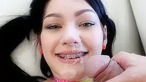 Karly Baker in The Original Brace Face - BraceFaced