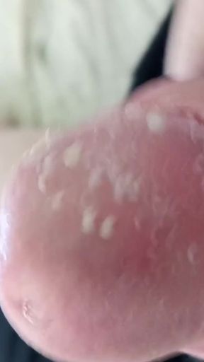 Smegma Foreskin Roll #2