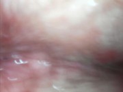 ENDOSCOPE