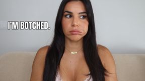 Plastic surgery ruined my face - OnlyVanessa