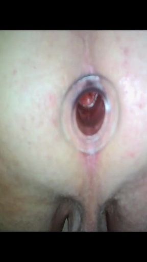 Anal Gape Extreme Close up Views