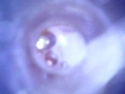 View inside cock while jerking and cumshot ( camera inside dick )