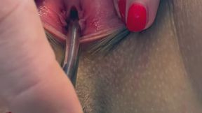 Urethra Fucking and Stretching – Sounding Session with Stretched Pee Hole