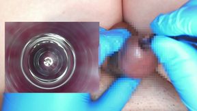 I put an endoscope in a 10mm test tube and observed the inside of the urethra.