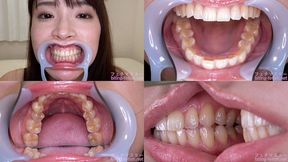 Hinata Tachibana - Watching Inside mouth of Japanese cute girl - MOV 1080p