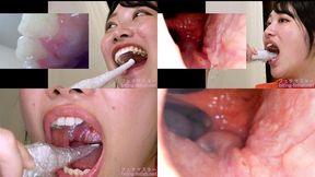 Miki Sunohara - Observing Sunohara Miki's teeth, mouth, and back of the throat with a dental camera - MOV