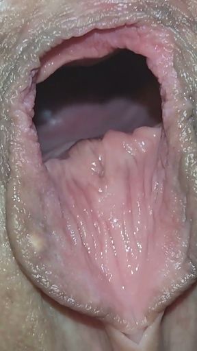 Cervix for Namsei (close-up)   Clip 1