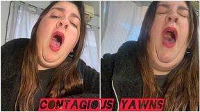 Stefi yawning deeply