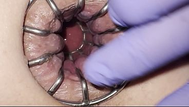 Reneenicolecd - update #30 - Gape anal stretch cage - Apr 19, 2026