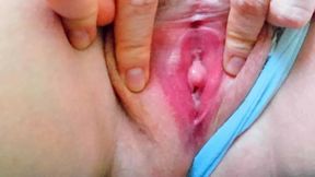 swollen and irritated pussy opening