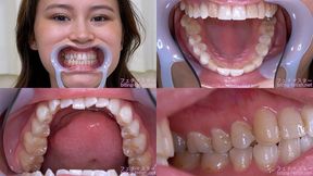 Erika Kononoba - Watching Inside mouth of Japanese cute girl - MOV 1080p