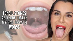 Tonsil stones and how I make my bad breath worst - Lalo Cortez and Vanessa (custom clip)