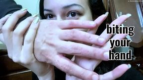 Many bites on the fingers and hand