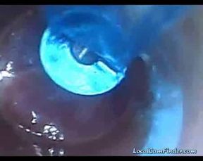 Endoscope POV: Test Tube Cock Urethral Insertion