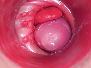 Inside a Camgirl Cervix POV Camera in Cunt with large jock toy