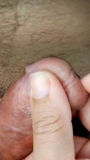 The Best Foreskin Circumcision Roleplay Handjob