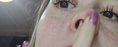 Runny Nose Close up