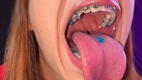Biting braces