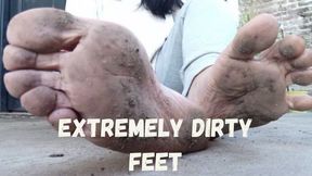 Extremely dirty feet