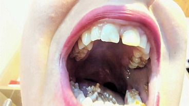 Sharp Big Teeth Eat and Gummies - Hardcore vore