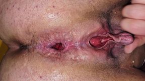 Gaping ass, big clit jerking