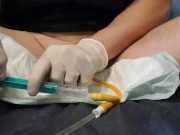 removal 20Fr catheter