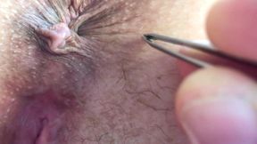 This is what happens when you ask your husband to help you remove the hair around the asshole and in the bikini area...