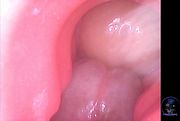 Intimaly Tserica Dildo Grinds Cock In Cockblock Frot Endoscope Pov