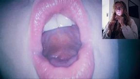 Endoscope in my mouth - burping mp4 HD