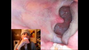 Endoscopy catarrh saliva and mouth exploration 720HD