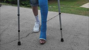 Blue LLC Adventure - Life with a Long Leg Cast - Platre jambe