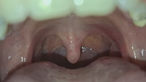 And this uvula?