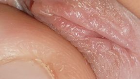 Enlargement of the Deep Urethral Hole!!